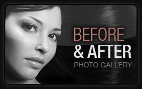 before and after photo gallery